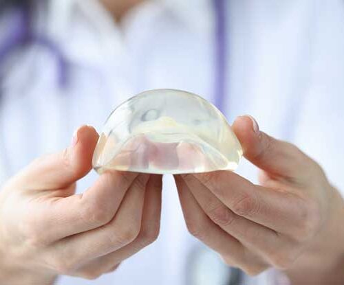 Breast Implant